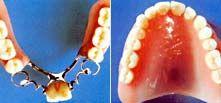 Leistungsspektrum Dentallabor (11)