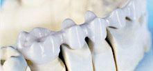 Leistungsspektrum Dentallabor (12)
