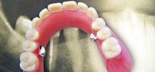 Leistungsspektrum Dentallabor (13)