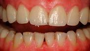 Leistungsspektrum Dentallabor (1)