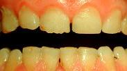Leistungsspektrum Dentallabor (4)