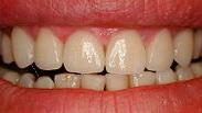 Leistungsspektrum Dentallabor (5)