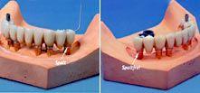 Leistungsspektrum Dentallabor (6)